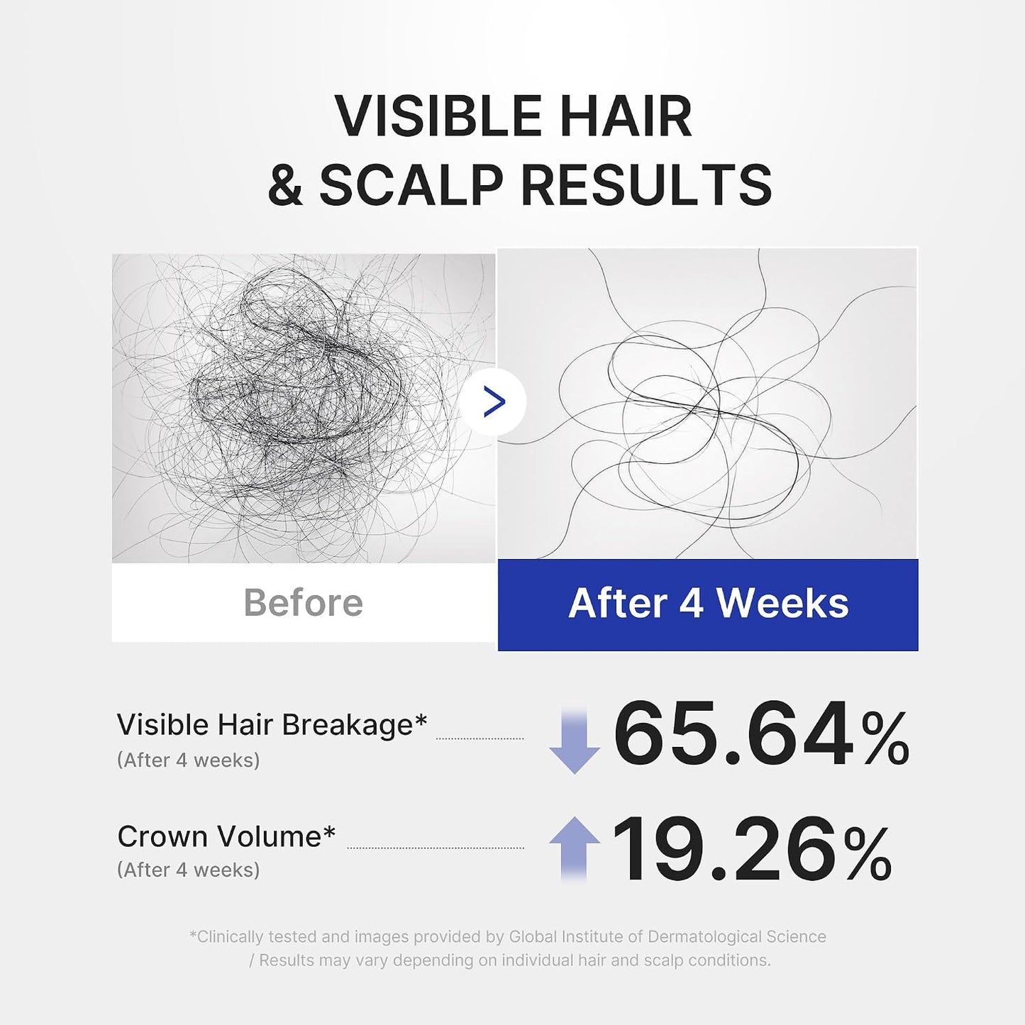 Deoxyribose Scalp Serum | For Fuller-Looking Hair & Scalp Strengthening Roll-On Serum | Deoxyribose, Rosemary, EGF, Caffeine for Fine, Thin Hair | Korean Hair Care, K-Beauty